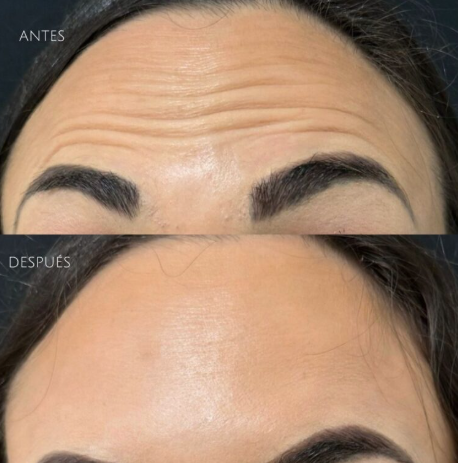 María | 44 años